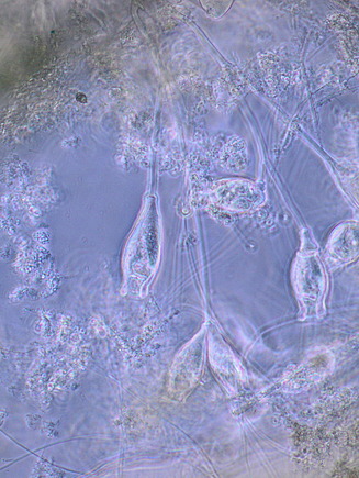 Microscopic view of LINPOR biofilm organisms attached to a porous surface. The image shows elongated and oval-shaped microorganisms with fine structures, captured under high magnification.